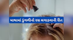 ખરતા વાળના કારણે માથામાં દેખાય છે ટાલ ? તો આ રીતે ડુંગળીનો રસ લગાડવાનું કરી દો શરુ 