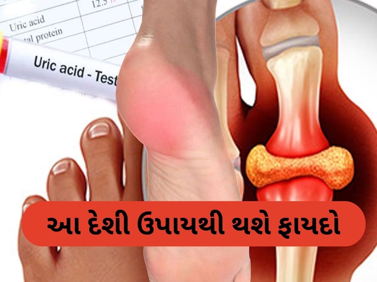 આ વસ્તુનું પાણી શરીરમાંથી યુરિક એસિડને ખેંચીને બહાર કાઢશે, જાણો તેનો ઉપયોગ કેવી રીતે કરવો આ વસ્તુનું પાણી શરીરમાંથી યુરિક એસિડને ખેંચીને બહાર કાઢશે, જાણો તેનો ઉપયોગ કેવી રીતે કરવો