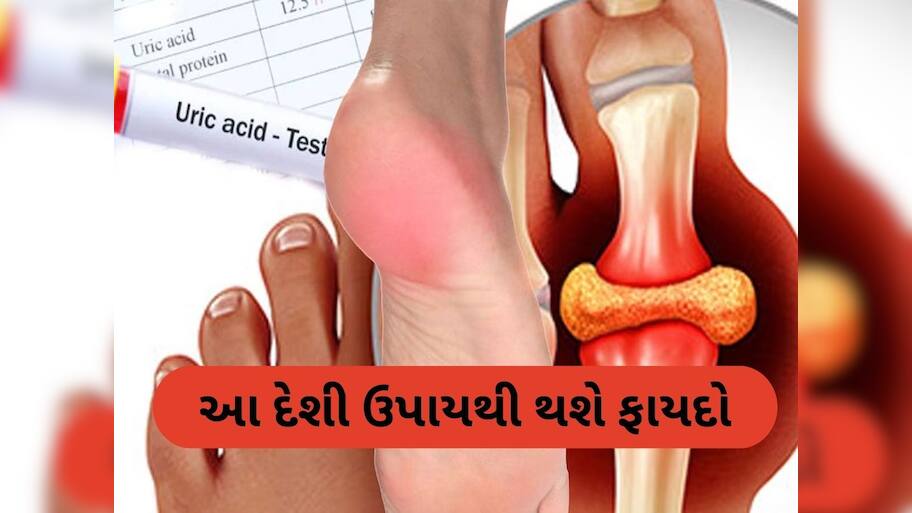 આ વસ્તુનું પાણી શરીરમાંથી યુરિક એસિડને ખેંચીને બહાર કાઢશે, જાણો તેનો ઉપયોગ કેવી રીતે કરવો
