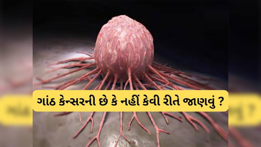 Cancer Tumor: કેન્સરની ગાંઠ શરીરમાં ક્યાં ક્યાં થઈ શકે ? શરીરના આ 5 અંગ સૌથી પહેલા થાય પ્રભાવિત