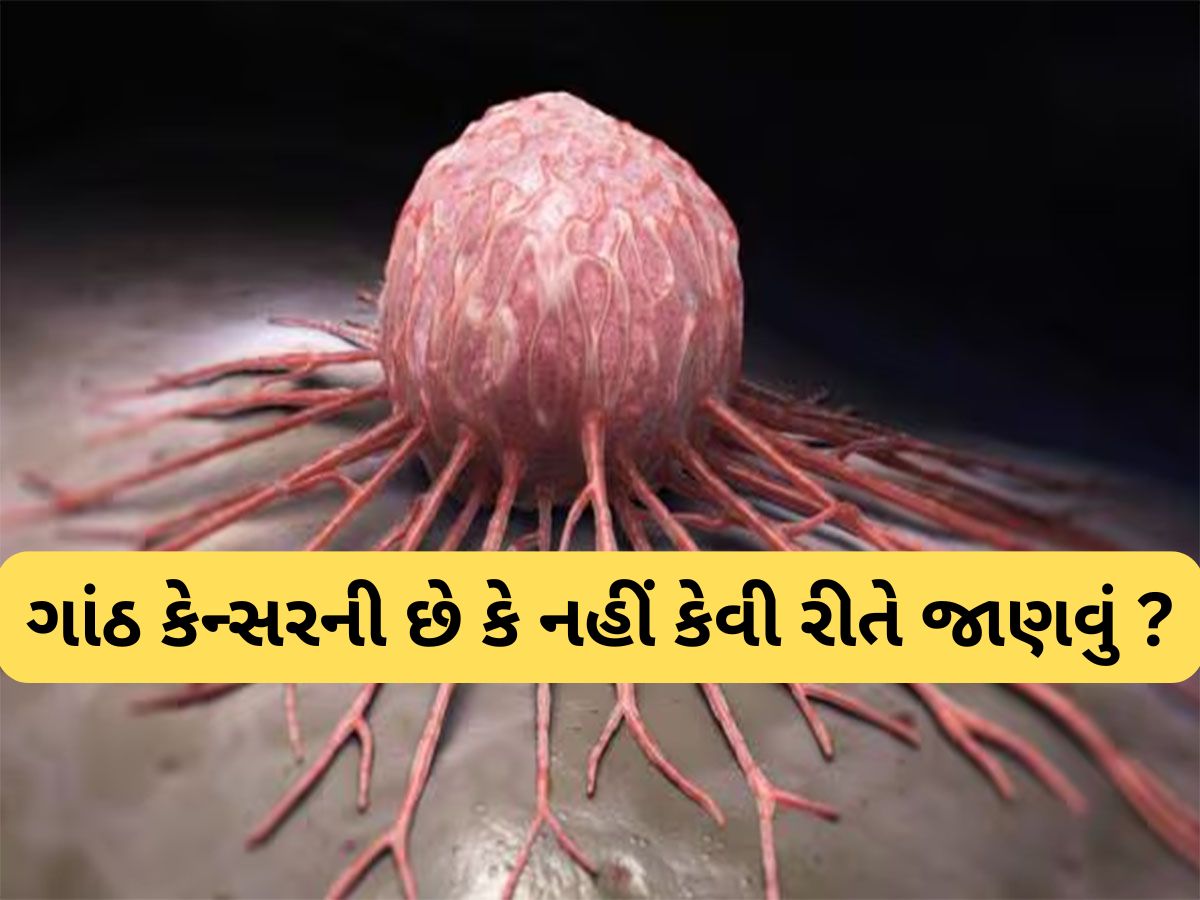 Cancer Tumor: કેન્સરની ગાંઠ શરીરમાં ક્યાં ક્યાં થઈ શકે ? શરીરના આ 5 અંગ સૌથી પહેલા થાય પ્રભાવિત Cancer Tumor: કેન્સરની ગાંઠ શરીરમાં ક્યાં ક્યાં થઈ શકે ? શરીરના આ 5 અંગ સૌથી પહેલા થાય પ્રભાવિત