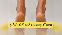 ફાટેલી એડી માટે રામબાણ છે આ 5 ઘરેલુ નુસખા, કોઈપણ 1 કરશો તો પણ તુરંત આરામ મળશે