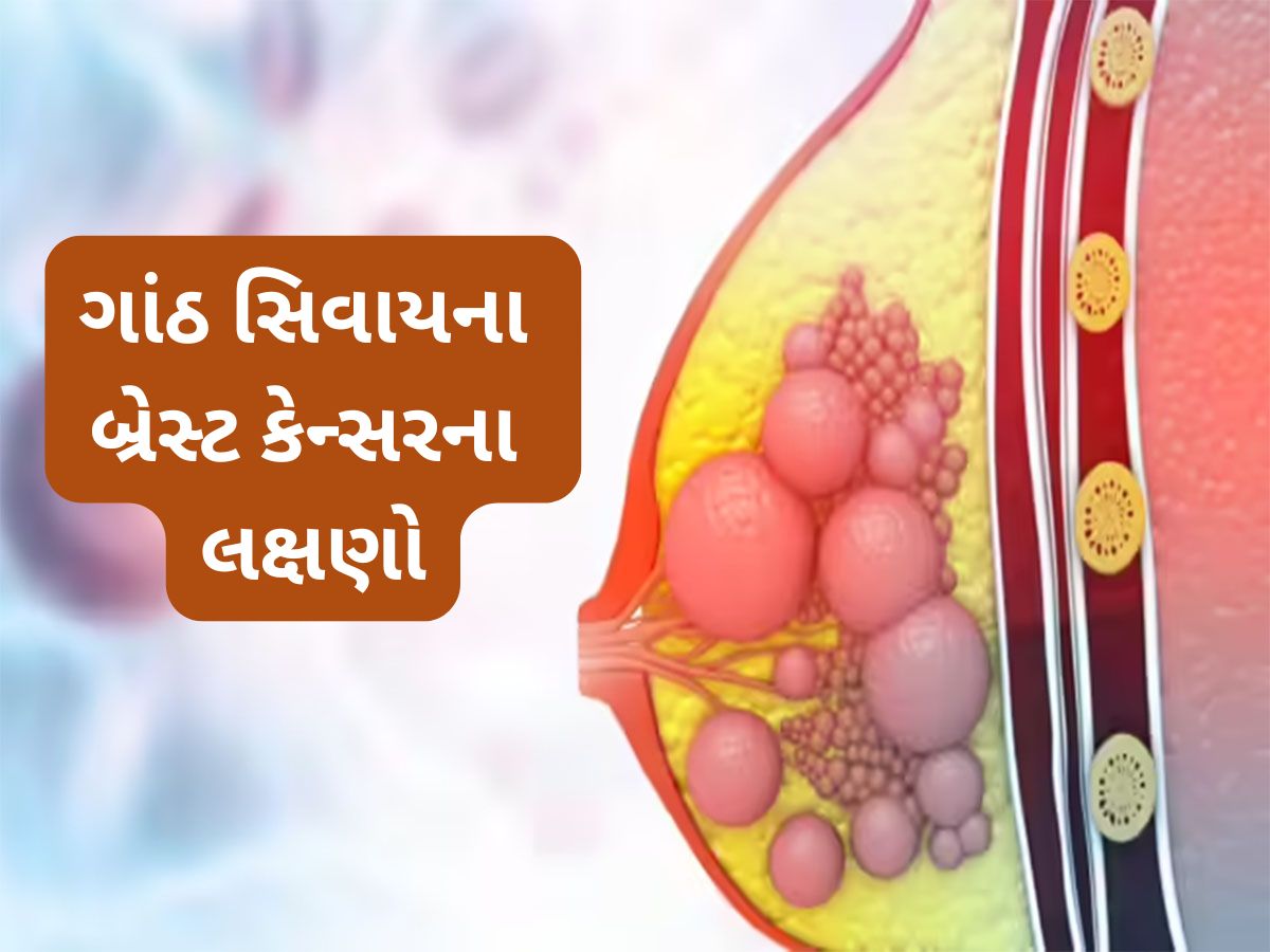 Breast Cancer: ગાંઠ સિવાયના બ્રેસ્ટ કેન્સરના લક્ષણો, મોટાભાગની મહિલાઓ અજાણતા કરી દે છે ઈગ્નોર Breast Cancer: ગાંઠ સિવાયના બ્રેસ્ટ કેન્સરના લક્ષણો, મોટાભાગની મહિલાઓ અજાણતા કરી દે છે ઈગ્નોર