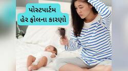 Hair Fall: ડિલીવરી પછી શા માટે ખરવા લાગે છે વાળ ? જાણો કારણ અને તેનો ઈલાજ
