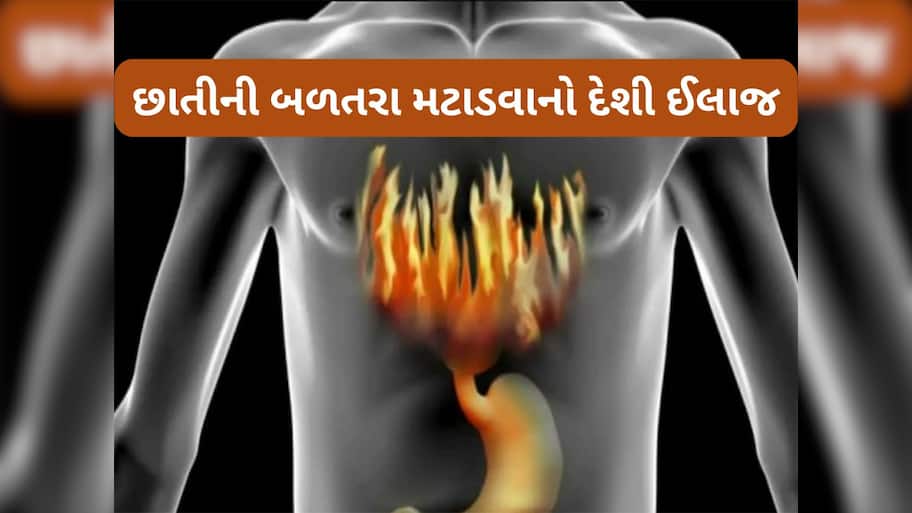 Health Tips: છાતીમાં થતી બળતરા તુરંત મટાડવી છે ? ટ્રાય કરો આ 3 માંથી કોઈ 1 ઉપાય