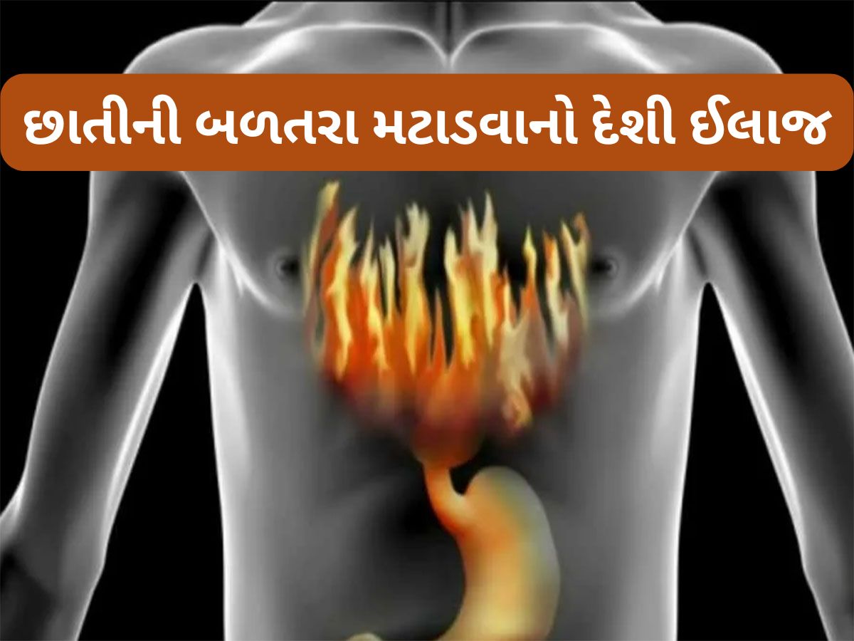 Health Tips: છાતીમાં થતી બળતરા તુરંત મટાડવી છે ? ટ્રાય કરો આ 3 માંથી કોઈ 1 ઉપાય Health Tips: છાતીમાં થતી બળતરા તુરંત મટાડવી છે ? ટ્રાય કરો આ 3 માંથી કોઈ 1 ઉપાય