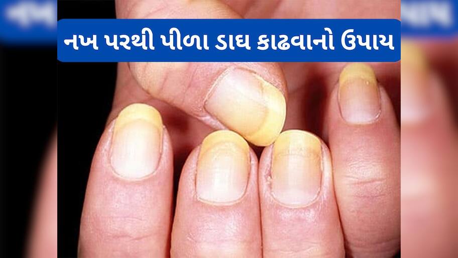 Nail Care: ઘરે બેઠા પીળા પડેલા નખની વધારો સુંદરતા, આ 5 ટીપ્સ ફોલો કરવાથી નખ થઈ જશે સાફ
