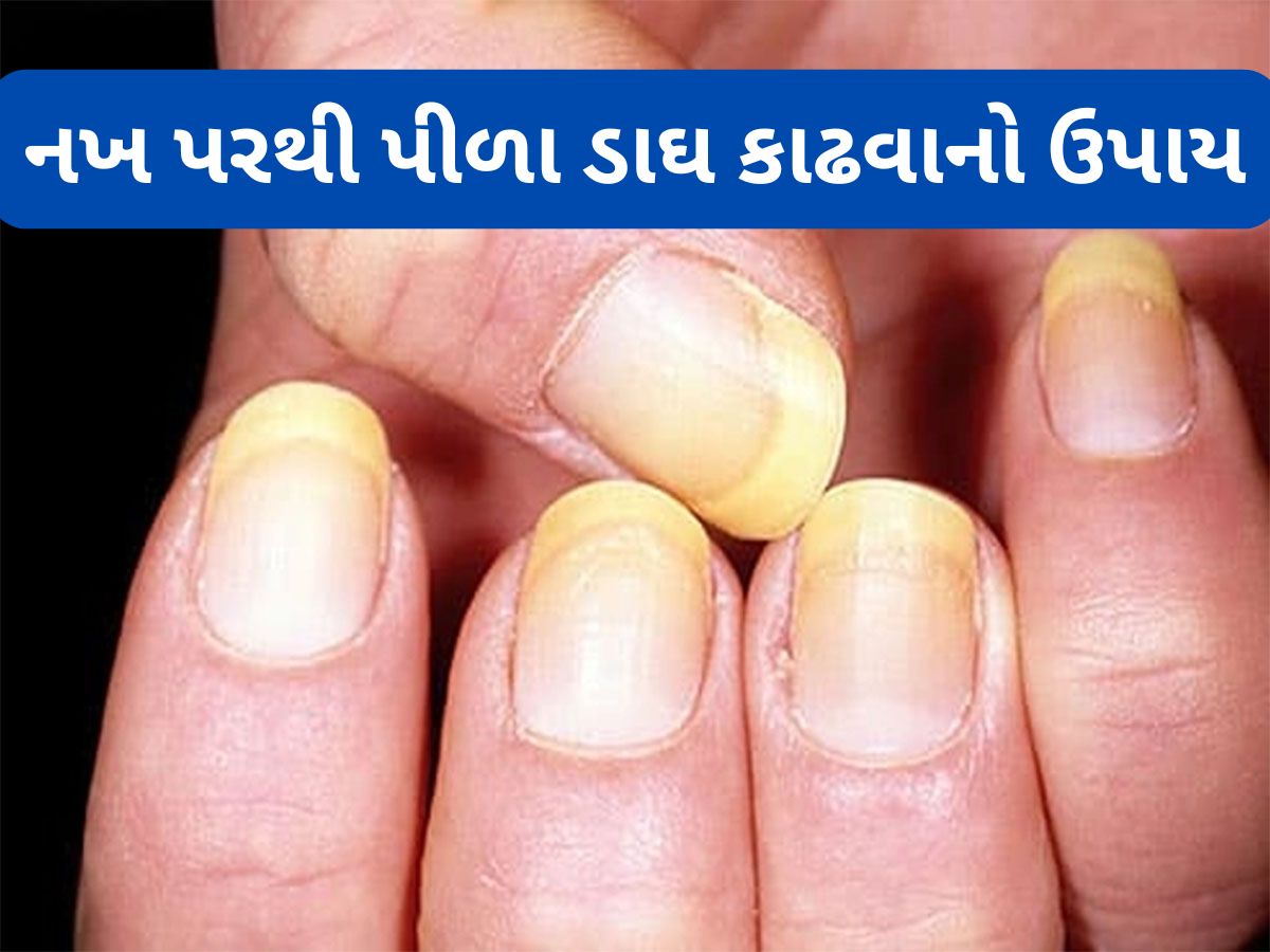 Nail Care: ઘરે બેઠા પીળા પડેલા નખની વધારો સુંદરતા, આ 5 ટીપ્સ ફોલો કરવાથી નખ થઈ જશે સાફ Nail Care: ઘરે બેઠા પીળા પડેલા નખની વધારો સુંદરતા, આ 5 ટીપ્સ ફોલો કરવાથી નખ થઈ જશે સાફ