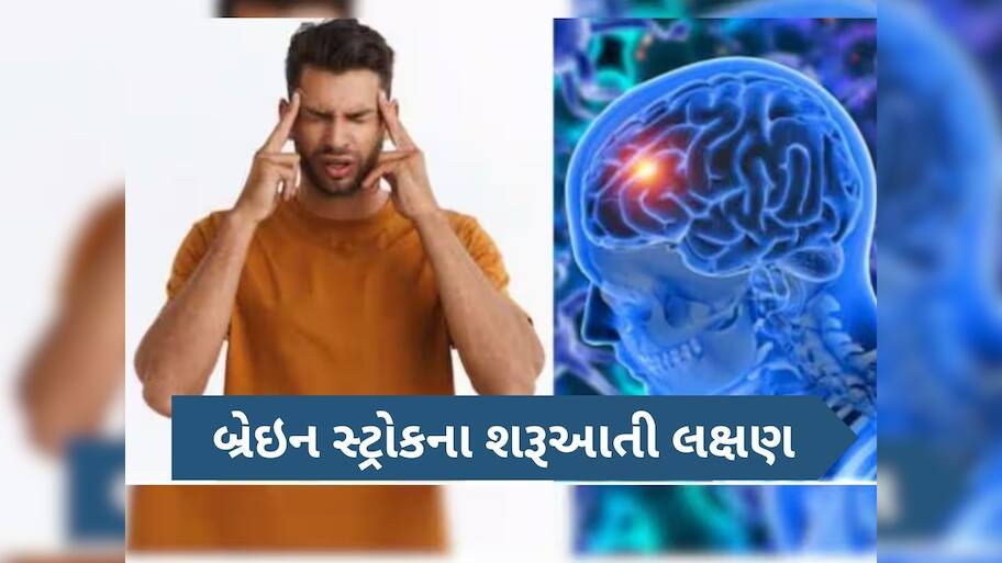  બ્રેઈન સ્ટ્રોક પહેલા શરીરમાં દેખાવા લાગે છે આ ગંભીર લક્ષણો, આ રીતે સંકેતોનો ઓળખો