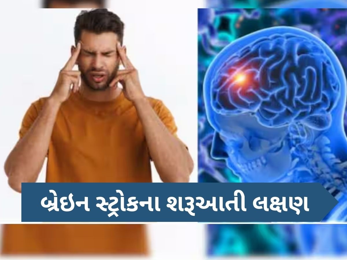 બ્રેઈન સ્ટ્રોક પહેલા શરીરમાં દેખાવા લાગે છે આ ગંભીર લક્ષણો, આ રીતે સંકેતોનો ઓળખો બ્રેઈન સ્ટ્રોક પહેલા શરીરમાં દેખાવા લાગે છે આ ગંભીર લક્ષણો, આ રીતે સંકેતોનો ઓળખો