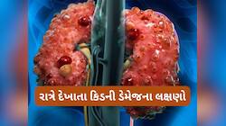 Kidney Damage: કિડની સડવાની શરુઆત થાય ત્યારે સૌથી પહેલા પગ પર દેખાય છે આવા લક્ષણો