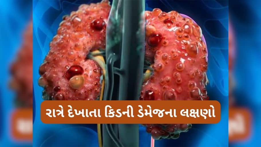 Kidney Damage Symptoms: કિડની સડવાની શરુઆત થાય ત્યારે સૌથી પહેલા પગ પર દેખાય છે આવા લક્ષણો