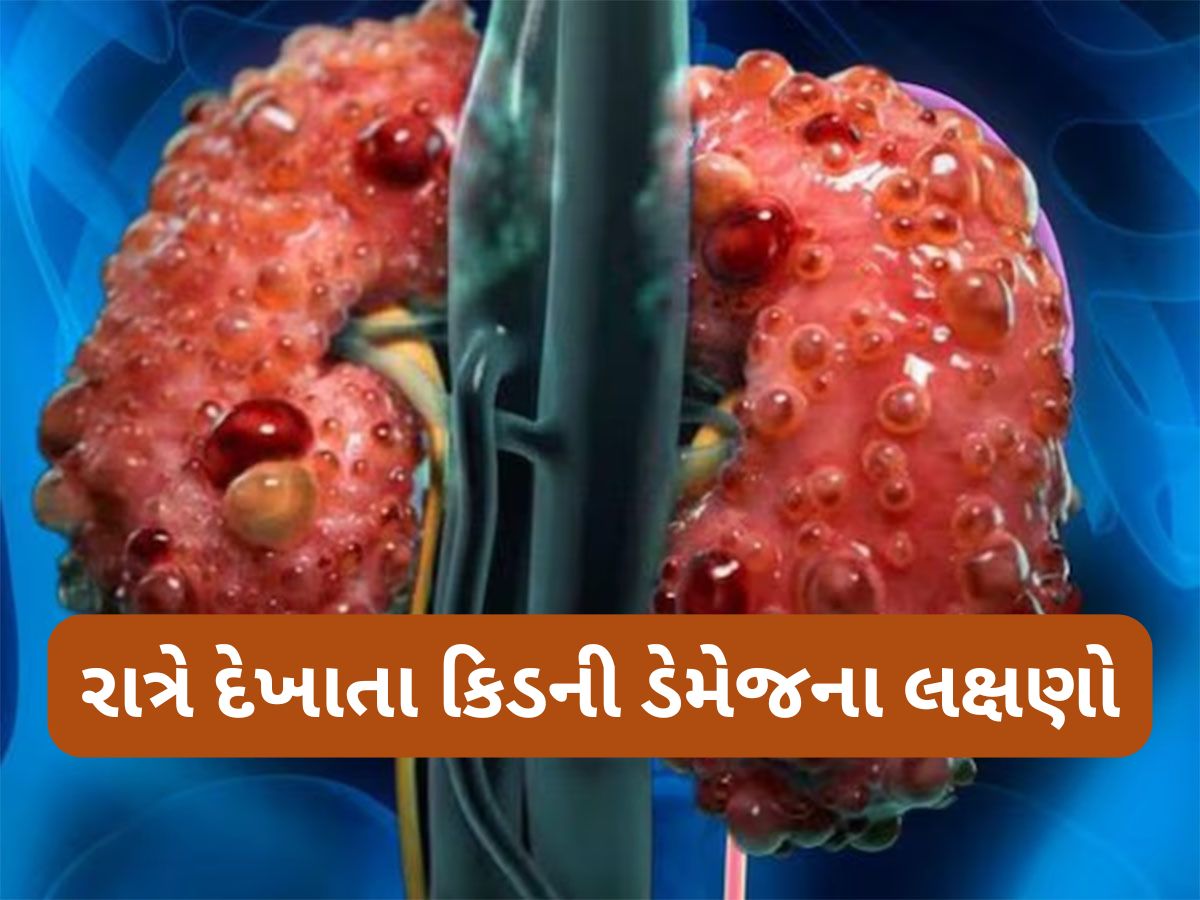 Kidney Damage Symptoms: કિડની સડવાની શરુઆત થાય ત્યારે સૌથી પહેલા પગ પર દેખાય છે આવા લક્ષણો Kidney Damage Symptoms: કિડની સડવાની શરુઆત થાય ત્યારે સૌથી પહેલા પગ પર દેખાય છે આવા લક્ષણો