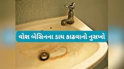 વોશ બેસિનના પીળા ડાઘ કાઢવા આ વસ્તુ લગાડો, સ્ક્રબરથી ઘસવું નહીં પડે અને ડાઘ સાફ થશે