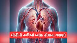 બેડ કોલેસ્ટ્રોલના કારણે લોહીની નળીઓ બ્લોક થઈ જાય ત્યારે શરીરમાં દેખાય આવા લક્ષણો