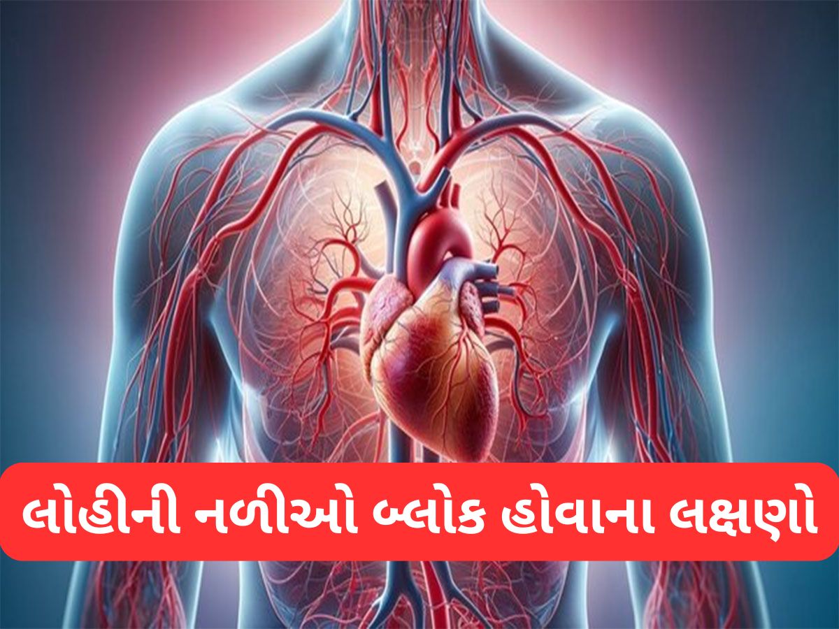 Bad Cholesterol: બેડ કોલેસ્ટ્રોલના કારણે લોહીની નળીઓ બ્લોક થઈ જાય ત્યારે શરીરમાં દેખાય આવા લક્ષણો Bad Cholesterol: બેડ કોલેસ્ટ્રોલના કારણે લોહીની નળીઓ બ્લોક થઈ જાય ત્યારે શરીરમાં દેખાય આવા લક્ષણો