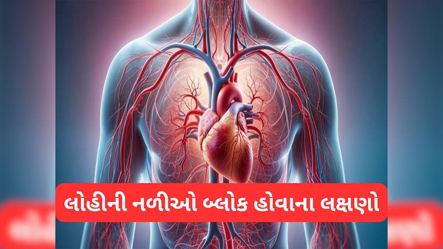 Bad Cholesterol: બેડ કોલેસ્ટ્રોલના કારણે લોહીની નળીઓ બ્લોક થઈ જાય ત્યારે શરીરમાં દેખાય આવા લક્ષણો
