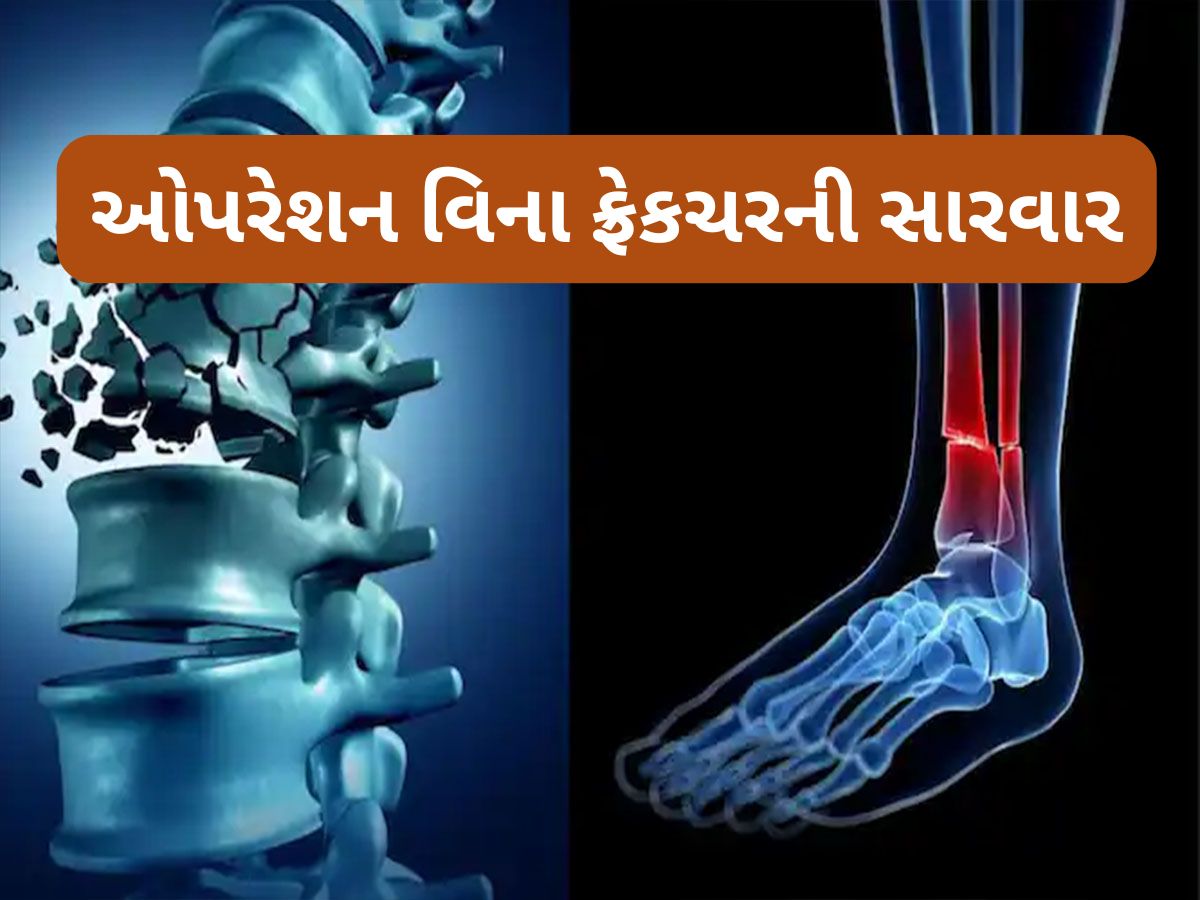 Bone Glue China: બસ 2 મિનિટમાં સર્જરી વિના જોડાય જાશે તૂટેલું હાડકું, બની ગયું દુનિયાનું પહેલું બોન ગ્લૂ Bone Glue China: બસ 2 મિનિટમાં સર્જરી વિના જોડાય જાશે તૂટેલું હાડકું, બની ગયું દુનિયાનું પહેલું બોન ગ્લૂ