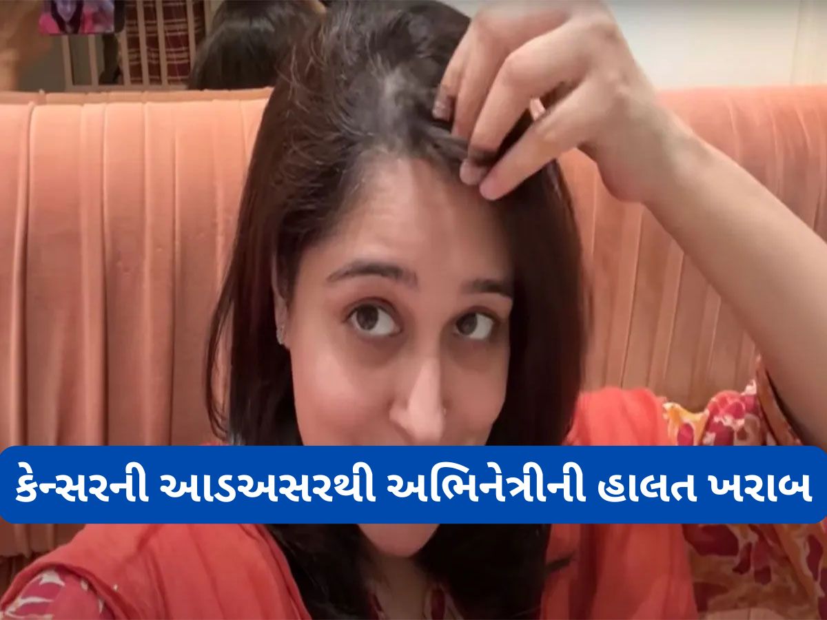 Dipika Kakar Ibrahim: લીવર કેન્સરની આડઅસરોથી દીપિકા કક્કરની હાલત બગડી, ખરવા લાગ્યા માથાના વાળ Dipika Kakar Ibrahim: લીવર કેન્સરની આડઅસરોથી દીપિકા કક્કરની હાલત બગડી, ખરવા લાગ્યા માથાના વાળ