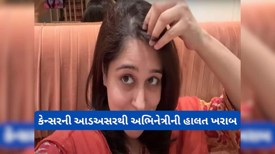 Dipika Kakar Ibrahim: લીવર કેન્સરની આડઅસરોથી દીપિકા કક્કરની હાલત બગડી, ખરવા લાગ્યા માથાના વાળ