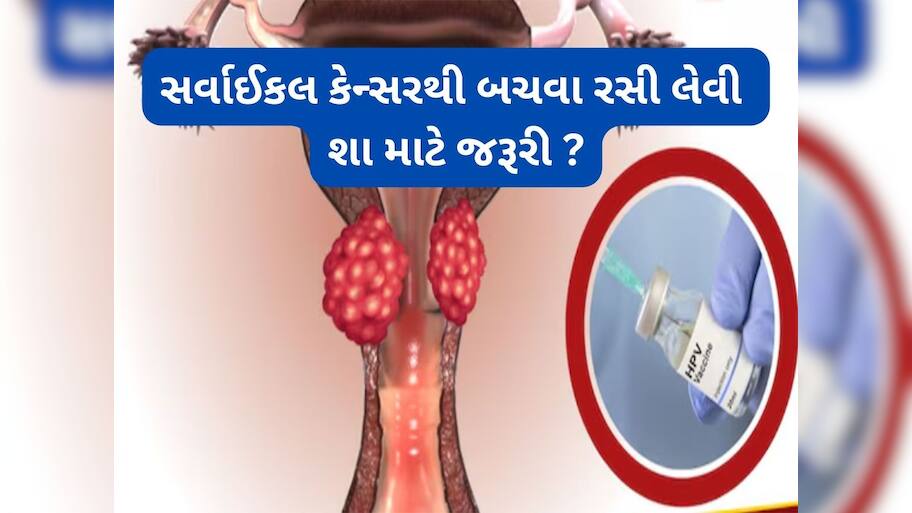 Cervical Cancer: સર્વાઈકલ કેન્સરથી બચવા માટે વેક્સીન લેવી શા માટે જરૂરી ? જાણો વેક્સીનેશનમાં કેટલો થાય ખર્ચ