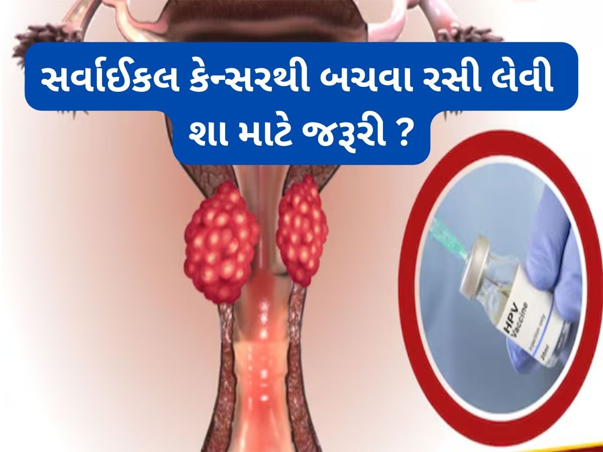 Cervical Cancer: સર્વાઈકલ કેન્સરથી બચવા માટે વેક્સીન લેવી શા માટે જરૂરી ? જાણો વેક્સીનેશનમાં કેટલો થાય ખર્ચ Cervical Cancer: સર્વાઈકલ કેન્સરથી બચવા માટે વેક્સીન લેવી શા માટે જરૂરી ? જાણો વેક્સીનેશનમાં કેટલો થાય ખર્ચ
