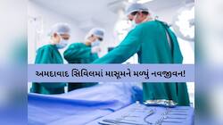 બાળકના પેટમાંથી કાઢ્યો વાળનો ગુચ્છો અને જૂતાની દોરી! આ દુર્લભ બિમારીનું શિકાર...