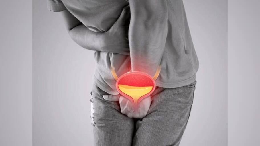  Prostate Cancer Early Signs: આ 5 લક્ષણ જોવા મળે તો હોઈ શકે છે પ્રોસ્ટેટ કેન્સર, પુરૂષો સીધા ડોક્ટર પાસે પહોંચે