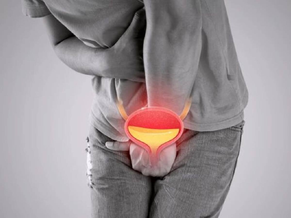 Prostate Cancer Early Signs: આ 5 લક્ષણ જોવા મળે તો હોઈ શકે છે પ્રોસ્ટેટ કેન્સર, પુરૂષો સીધા ડોક્ટર પાસે પહોંચે Prostate Cancer Early Signs: આ 5 લક્ષણ જોવા મળે તો હોઈ શકે છે પ્રોસ્ટેટ કેન્સર, પુરૂષો સીધા ડોક્ટર પાસે પહોંચે