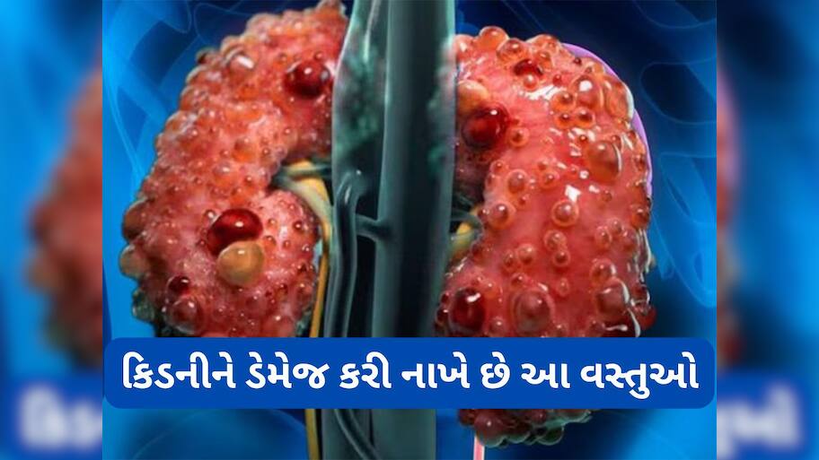 Kidney Health: આ વસ્તુઓ છે હેલ્ધી પણ કિડની સંબંધિત સમસ્યા હોય તેવા લોકો માટે છે હાનિકારક