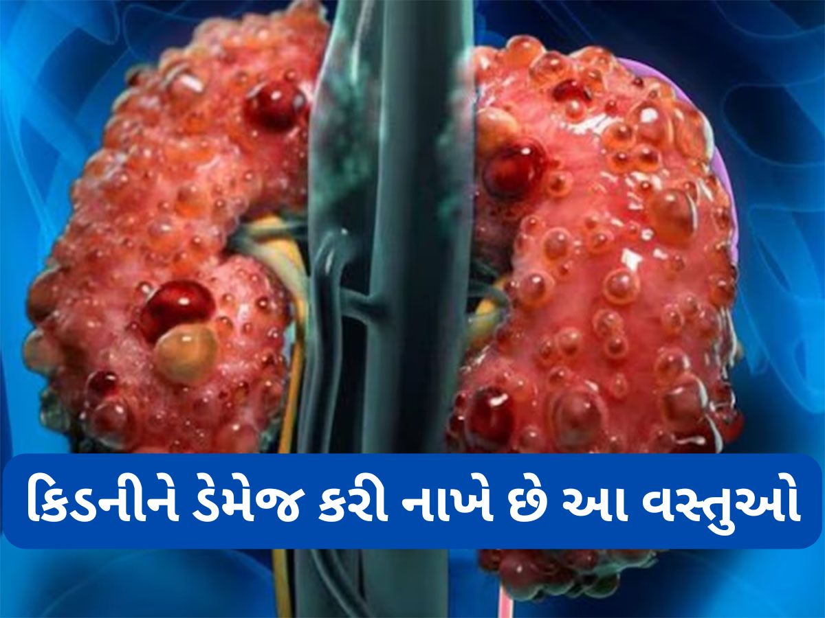 Kidney Health: આ વસ્તુઓ છે હેલ્ધી પણ કિડની સંબંધિત સમસ્યા હોય તેવા લોકો માટે છે હાનિકારક Kidney Health: આ વસ્તુઓ છે હેલ્ધી પણ કિડની સંબંધિત સમસ્યા હોય તેવા લોકો માટે છે હાનિકારક