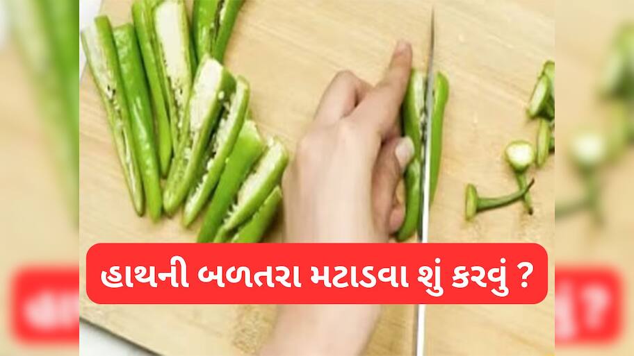 Skin Burning: મરચા કાપ્યા પછી હાથમાં થતી બળતરા મટાડવાના 5 ઘરેલુ ઉપાય, તુરંત મટી જશે બળતરા