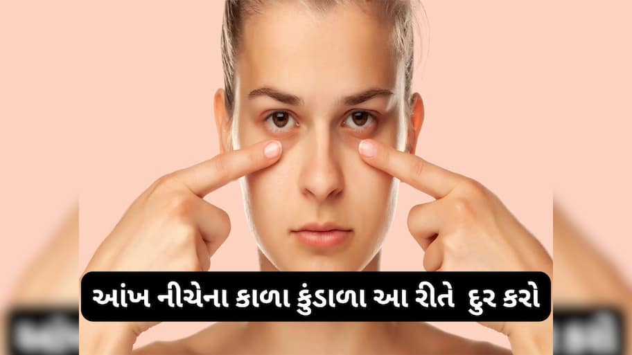 Dark Circles: ઉજાગરાના કારણે આંખ નીચે થયેલા ડાર્ક સર્કલ દુર કરવાના 4 અસરદાર ઘરેલુ નુસખા