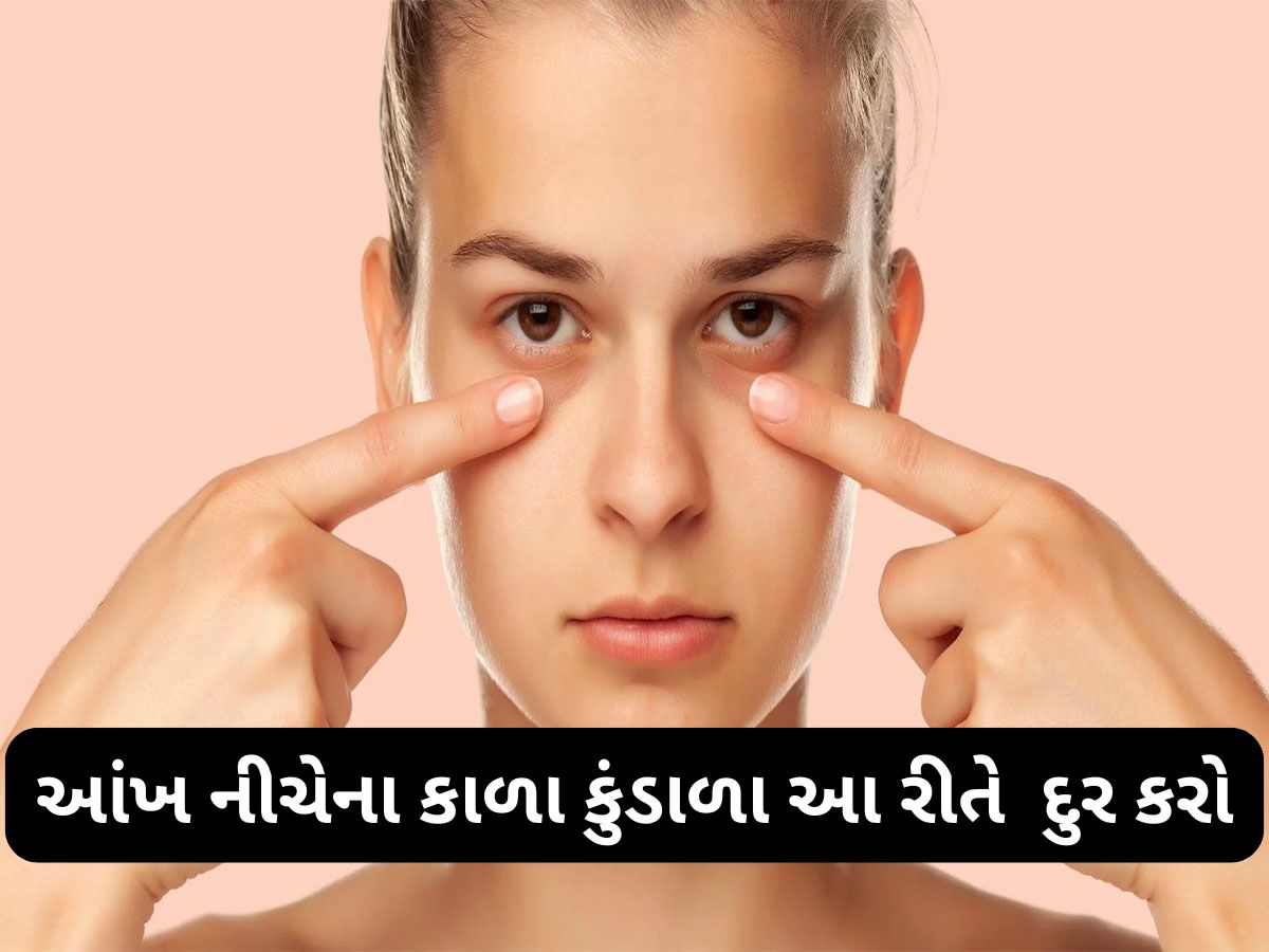 Dark Circles: ઉજાગરાના કારણે આંખ નીચે થયેલા ડાર્ક સર્કલ દુર કરવાના 4 અસરદાર ઘરેલુ નુસખા Dark Circles: ઉજાગરાના કારણે આંખ નીચે થયેલા ડાર્ક સર્કલ દુર કરવાના 4 અસરદાર ઘરેલુ નુસખા