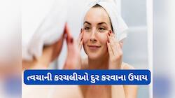 Skin Tightening: ઢીલી પડતી ત્વચા ટાઈટ દેખાશે, અપનાવી લો આ જબરદસ્ત ઘરેલુ નુસખા