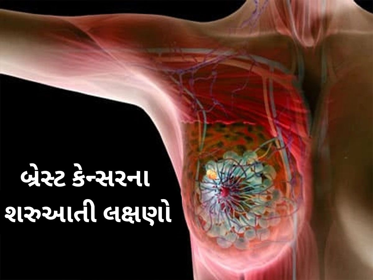 Breast Cancer: બ્રેસ્ટ કેન્સરના પહેલા સ્ટેજમાં દેખાય છે આ લક્ષણો, ઈગ્નોર કરવું પડશે ભારે