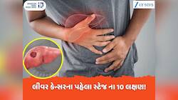 લીવર કેન્સરના પહેલા સ્ટેજમાં જોવા મળે છે આ 10 લક્ષણ, દેખાય તો તરત દોડજો ડોક્ટર પાસે