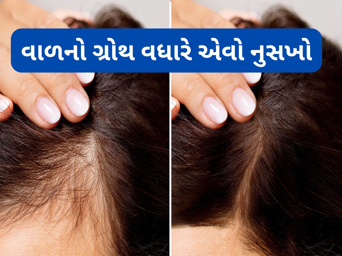 Hair Fall: હેર ગ્રોથ વધારવાનો અસરદાર નુસખો, સરસવના તેલમાં આ 5 વસ્તુ મિક્સ કરી વાળમાં લગાડો
