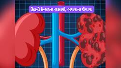 કિડની કેન્સર થતા પહેલા જોવા મળે છે આ 3 લક્ષણ, જાણો કેવી રીતે બચી શકો