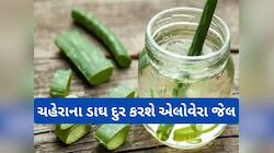 aloe vera : ચહેરાના ડાઘ-ધબ્બા દુર કાયમ માટે દુર કરવા આ રીતે યુઝ કરો એલોવેરા