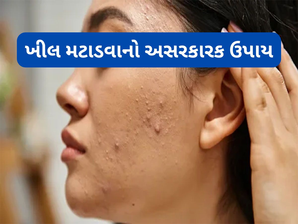 Beauty Tips: એલોવેરામાં આ 2 વસ્તુ મિક્સ કરી ખીલ પર રાત્રે લગાડો, સવારે સ્કિન હશે એકદમ ક્લીયર Beauty Tips: એલોવેરામાં આ 2 વસ્તુ મિક્સ કરી ખીલ પર રાત્રે લગાડો, સવારે સ્કિન હશે એકદમ ક્લીયર
