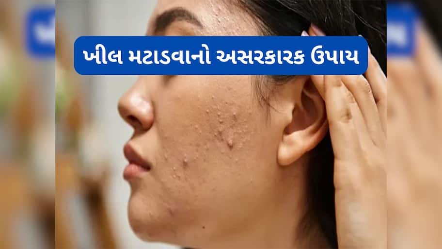 Beauty Tips: એલોવેરામાં આ 2 વસ્તુ મિક્સ કરી ખીલ પર રાત્રે લગાડો, સવારે સ્કિન હશે એકદમ ક્લીયર