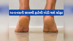 પગના વાઢિયા મટાડવા અનાનસની છાલનો આ રીતે કરો ઉપયોગ, રુ જેવી સોફ્ટ થઈ જશે ફાટેલી ત્વચા