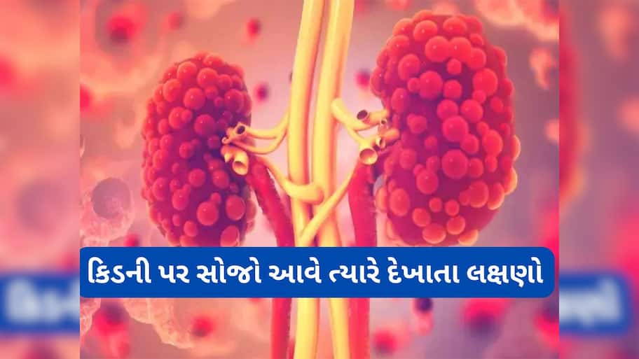 Kidney Health: કિડની પર સોજો હોય ત્યારે દેખાય છે આ 5 લક્ષણો, સમયસર ધ્યાન ન આપો તો કિડની થઈ જાય ફેલ