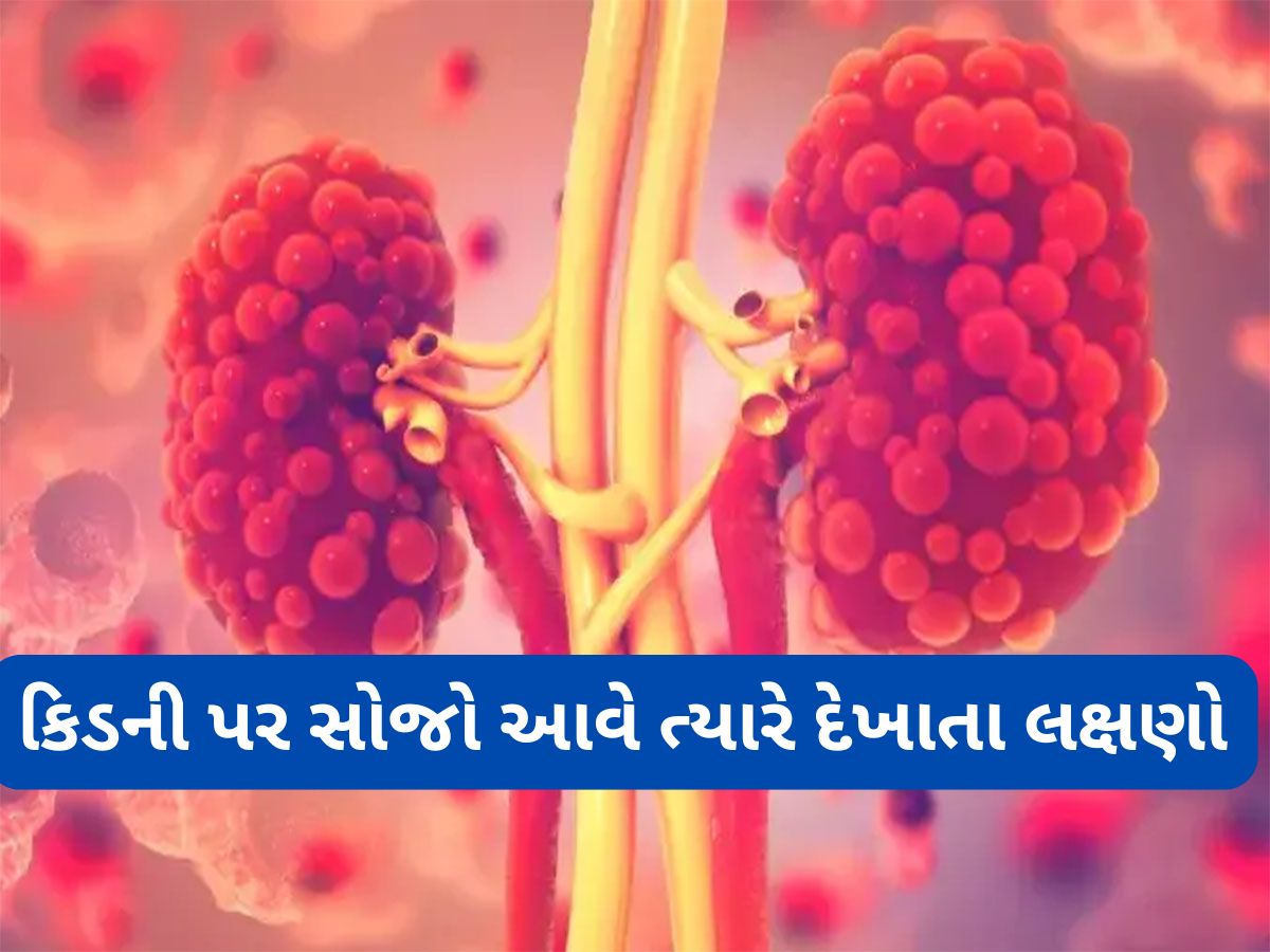 Kidney Health: કિડની પર સોજો હોય ત્યારે દેખાય છે આ 5 લક્ષણો, સમયસર ધ્યાન ન આપો તો કિડની થઈ જાય ફેલ Kidney Health: કિડની પર સોજો હોય ત્યારે દેખાય છે આ 5 લક્ષણો, સમયસર ધ્યાન ન આપો તો કિડની થઈ જાય ફેલ
