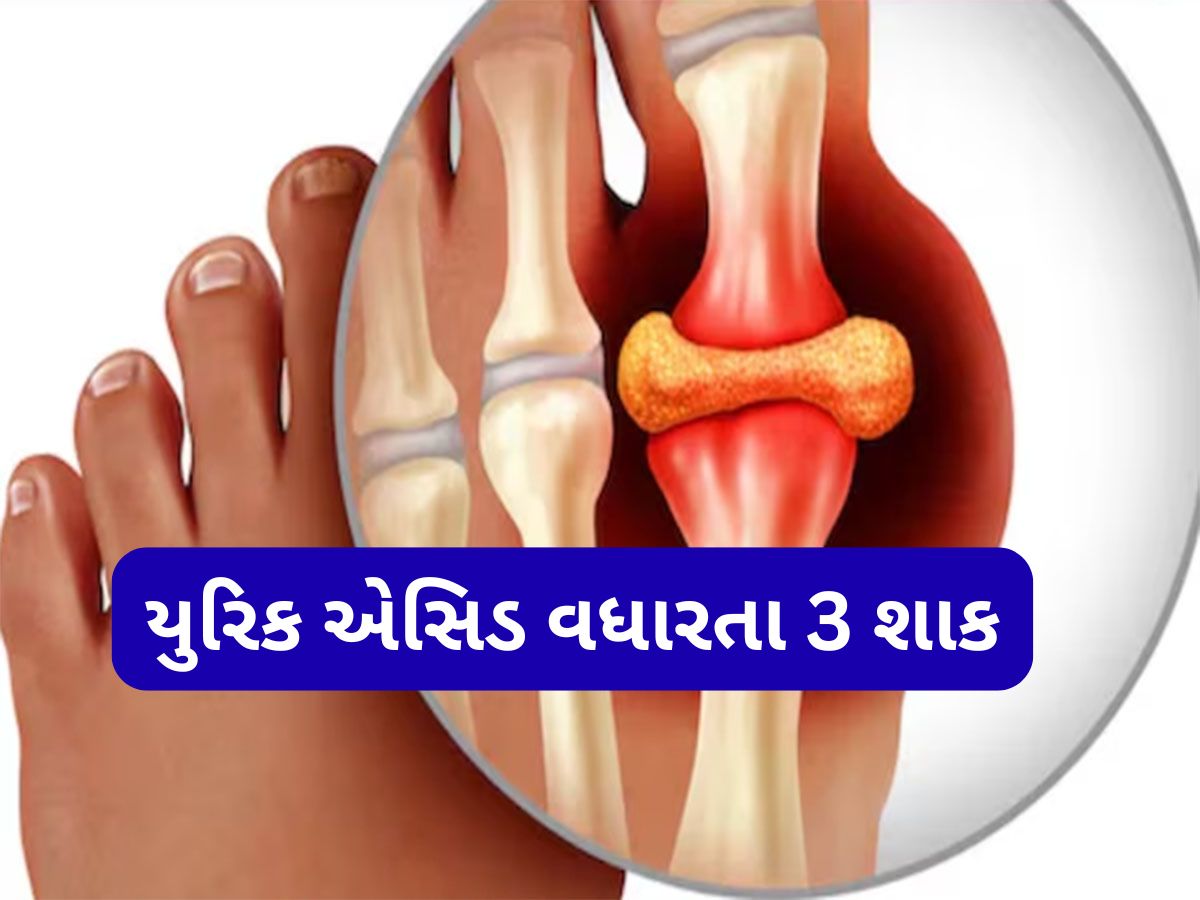 Uric Acid: યુરિક એસિડના દર્દીએ શિયાળામાં ન ખાવા આ 3 શાક, અસહ્ય થઈ જશે સાંધાનો દુખાવો Uric Acid: યુરિક એસિડના દર્દીએ શિયાળામાં ન ખાવા આ 3 શાક, અસહ્ય થઈ જશે સાંધાનો દુખાવો