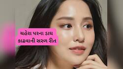 Skin Care: ચહેરા પરના બધા જ ડાઘ થઈ જશે સાફ, સ્કિન પર લગાડો આ 2 વસ્તુ