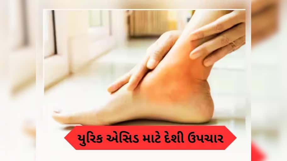 ઘર પર થઈ જશે યુરિક એસિડનો ઇલાજ, દવા લેતાં પહેલા અજમાવો આ ઉપાય