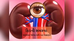 કિડનીમાં ગંભીર સમસ્યા હોય તો આંખોમાં જોવા મળે આ 3 સંકેત! મહિલાએ જણાવી ચોંકાવનારી વાત