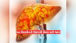 શરીરમાં આ વિટામીનની કમી હોય તો લિવર સડવા લાગે છે, તબાહ થઈ જાય છે, જરાય અવગણતા નહીં